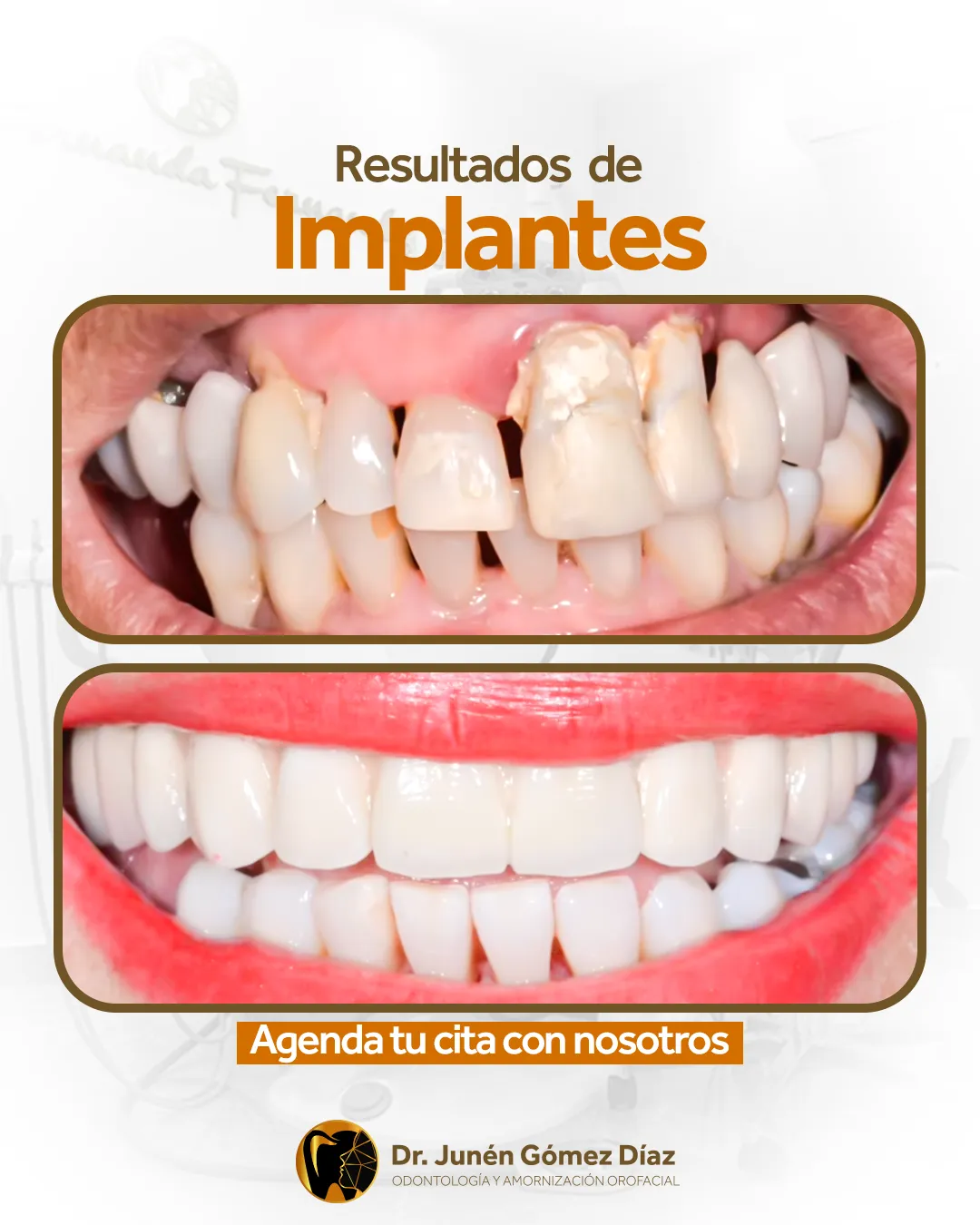 Dr. Junen — Pieza para redes