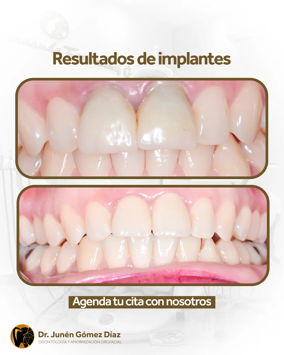 Dr. Junen — Pieza para redes