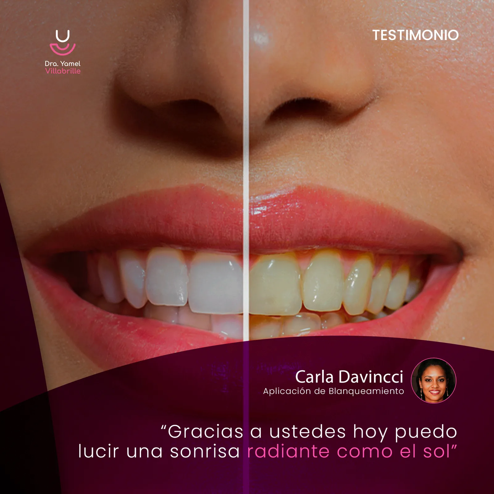 Dra. Yamel Villabrille — Evento