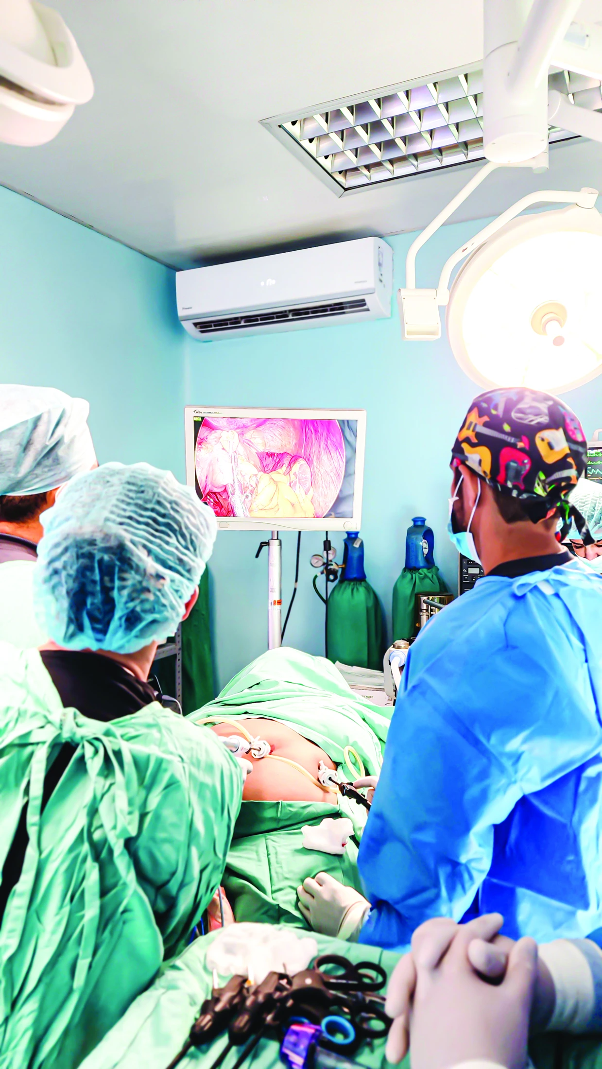 Gastro Surg — Pieza original · Foto-Carpeta